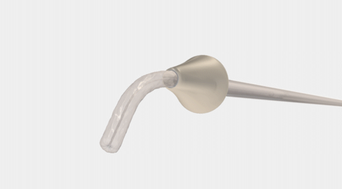 Medical Inserter Bayer and CrossBay Medical Collaborate on Development of Novel IUD ...