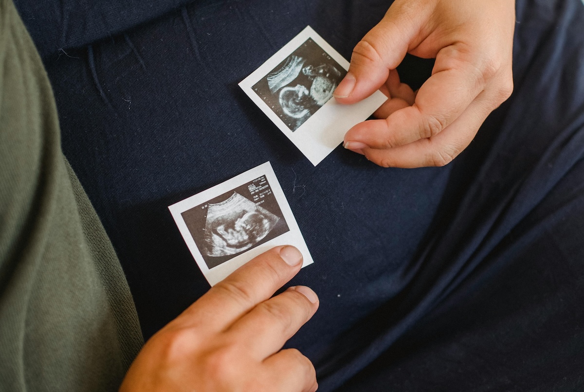 Gedeon Richter Takes ‘Significant Equity Stake’ in Fertility Company Granata Bio 