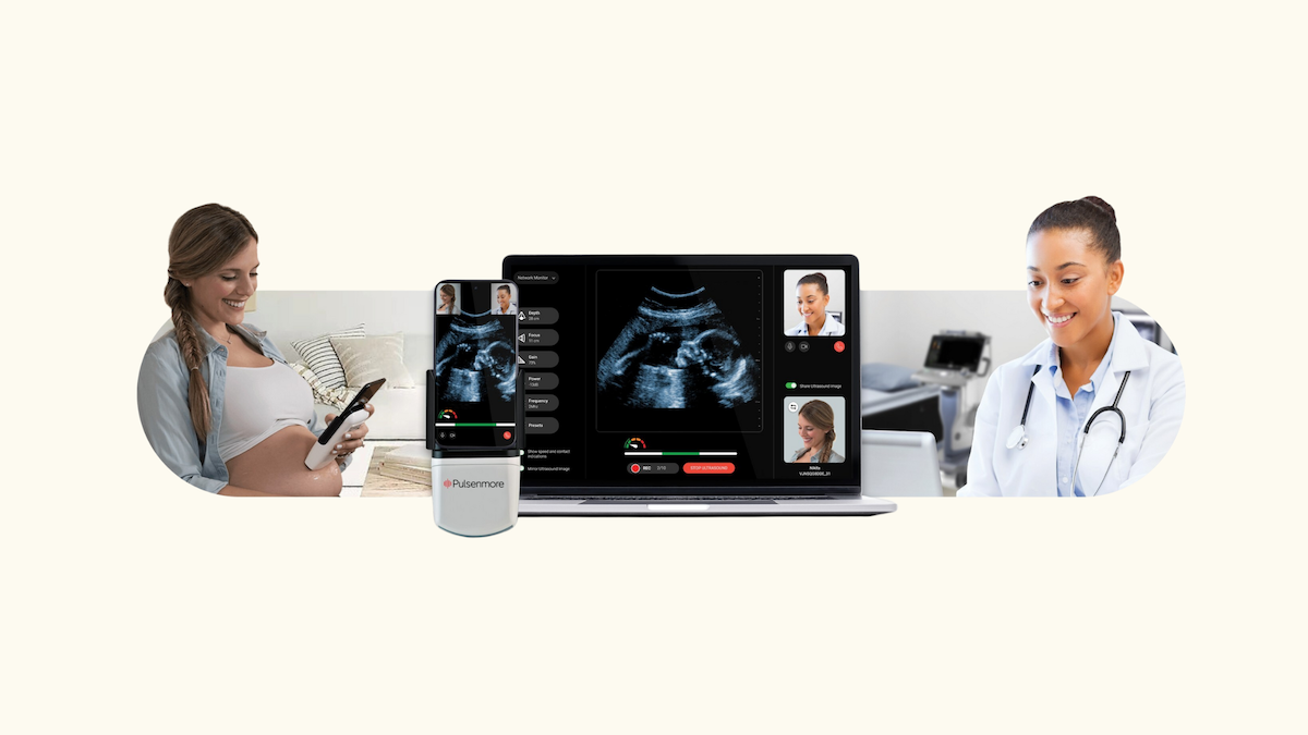 Pulsenmore Receives FDA De Novo Authorization for Home Prenatal Ultrasound Device 